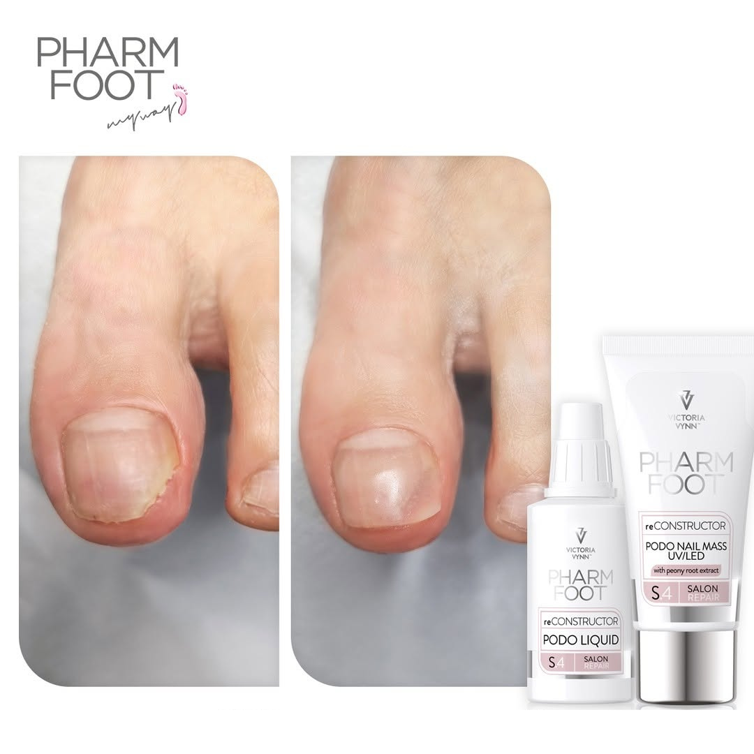 PHARM FOOT Nail reconstructor, reConstructor Podo Nail Set UV/LED