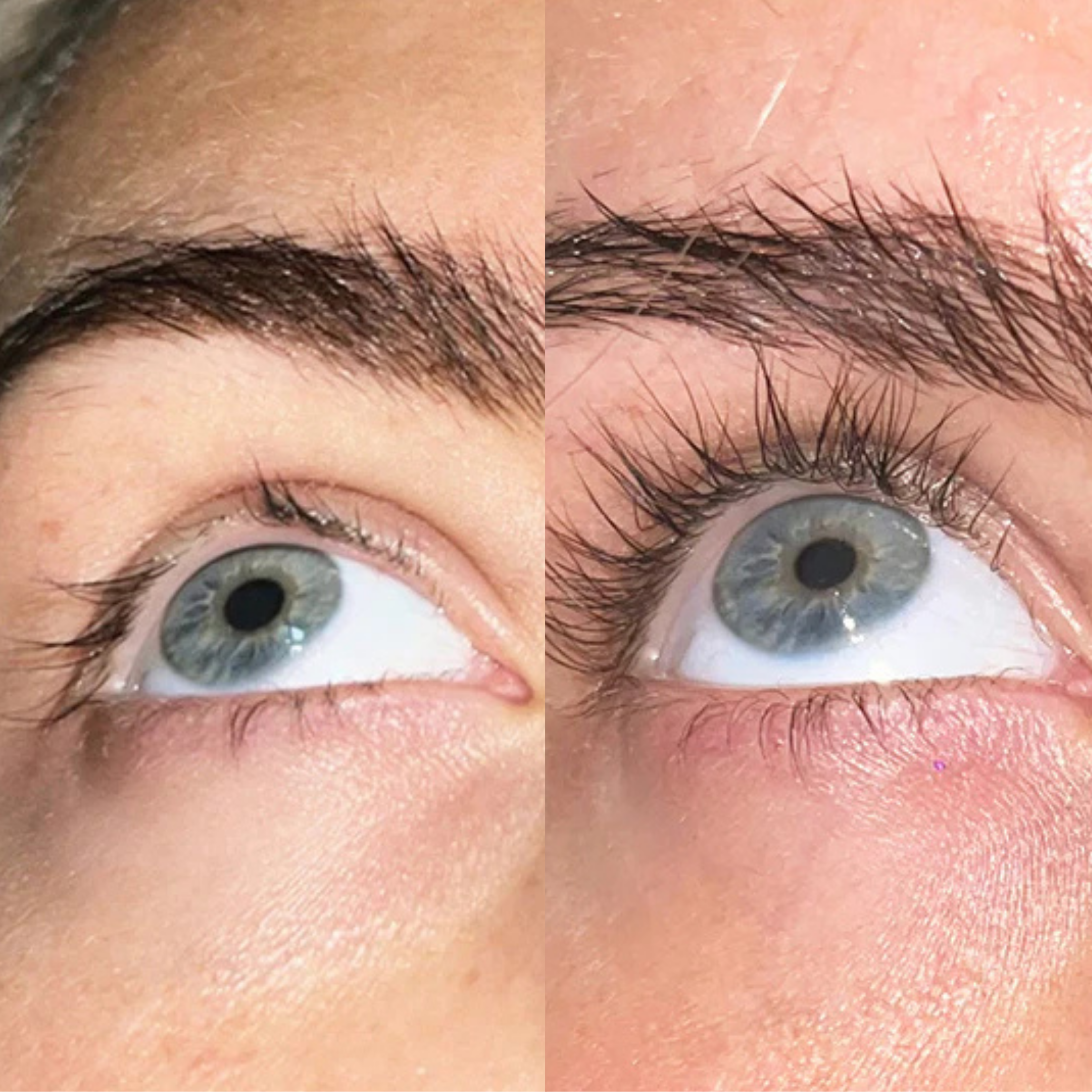 XLASH Eyelash Serum - eyelash serum, 5 ml
