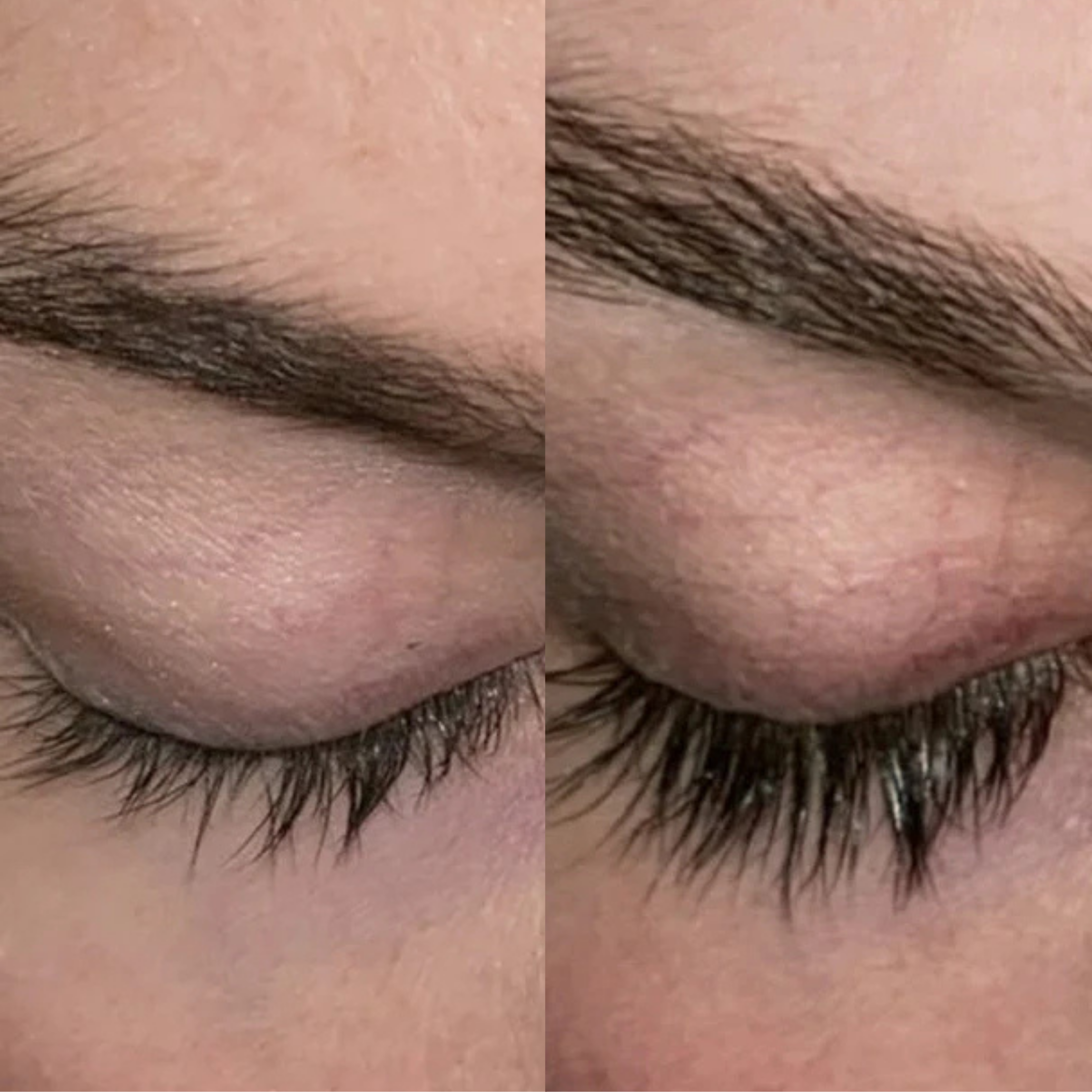XLASH Eyelash Serum - eyelash serum, 5 ml