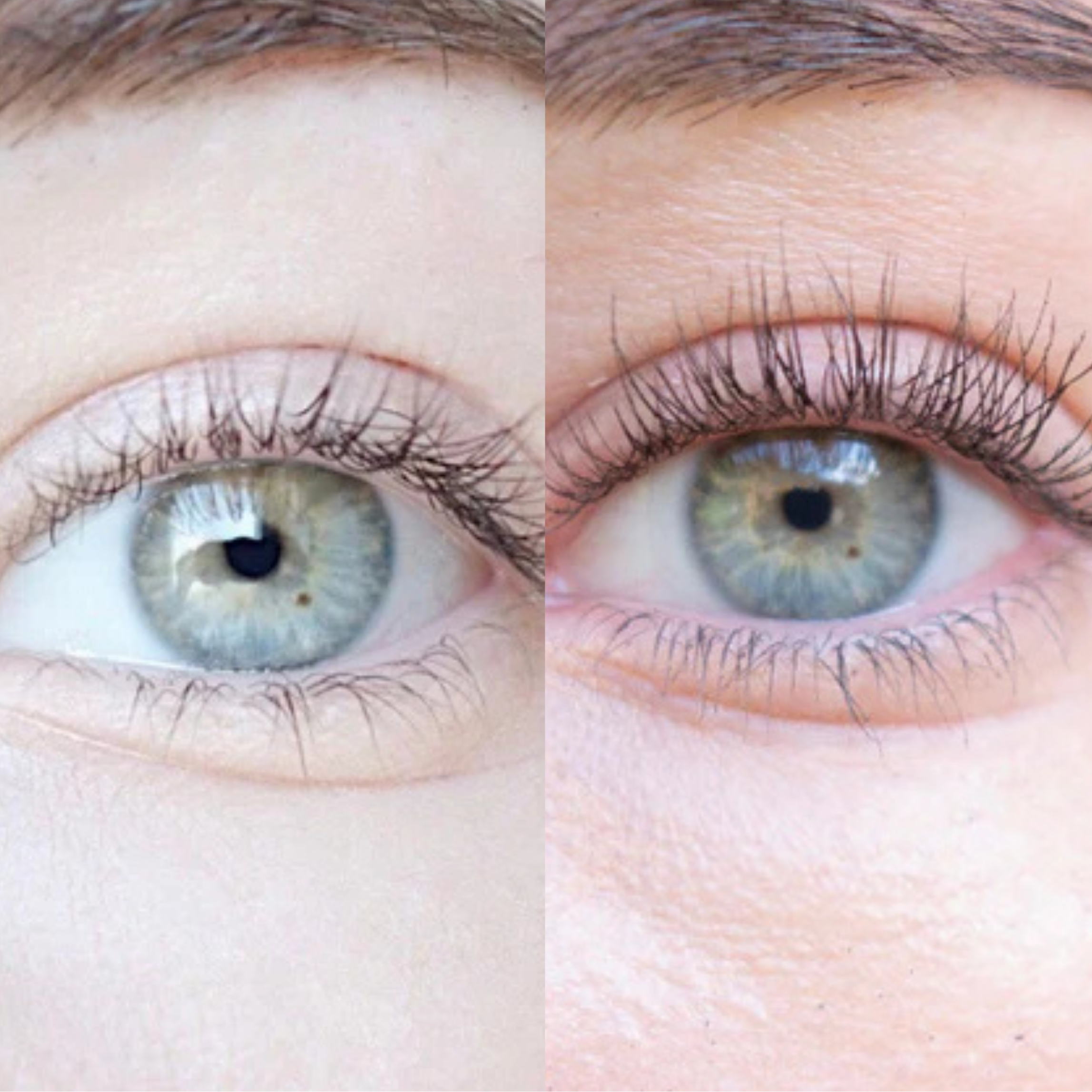 XLASH Eyelash Serum - eyelash serum, 5 ml