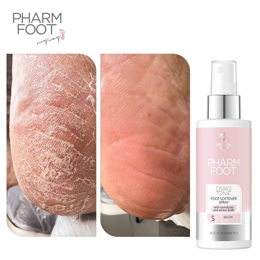 PHARM FOOT Skin and callus softener, OSMO TONIC 150ml